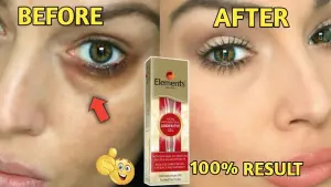 UNDER EYE GEL 15 GMS 