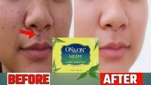NEEM SOAP 75 GMS 